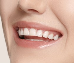 Cosmetic Dentistry thumb