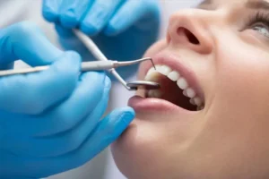 The Benefits Of Oral Health Consultation